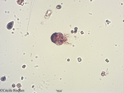 protozoo/Strombidium sp1 (1)(copy)_thumb.jpg